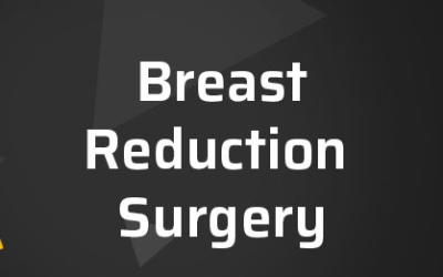 Meet Geraldine – Our Breast Reduction Patient.